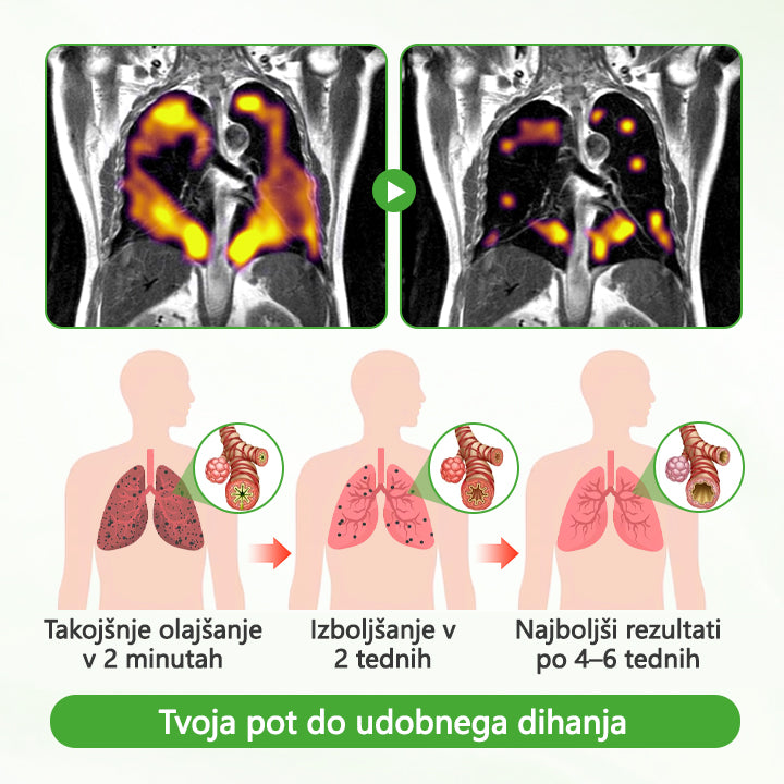 🌿🌿CleraNaure® HerbaAir Mullein Prečiščevalec Pljuč