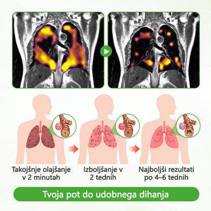 🌿🌿CleraNaure® HerbaAir Mullein Prečiščevalec Pljuč